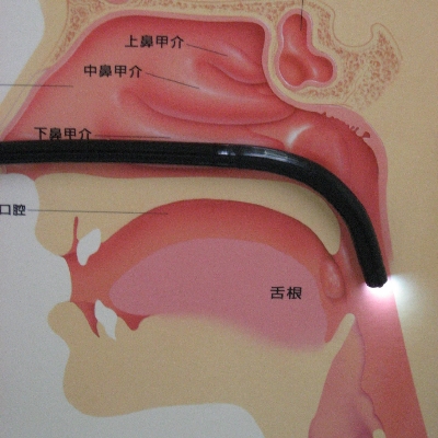 胃カメラ経鼻挿入図